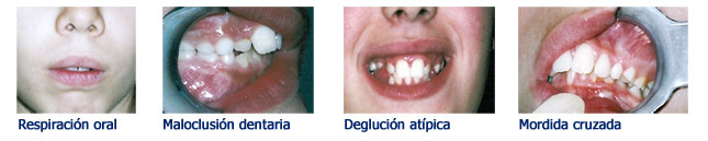 ortodoncia-y-terapia-miofuncional