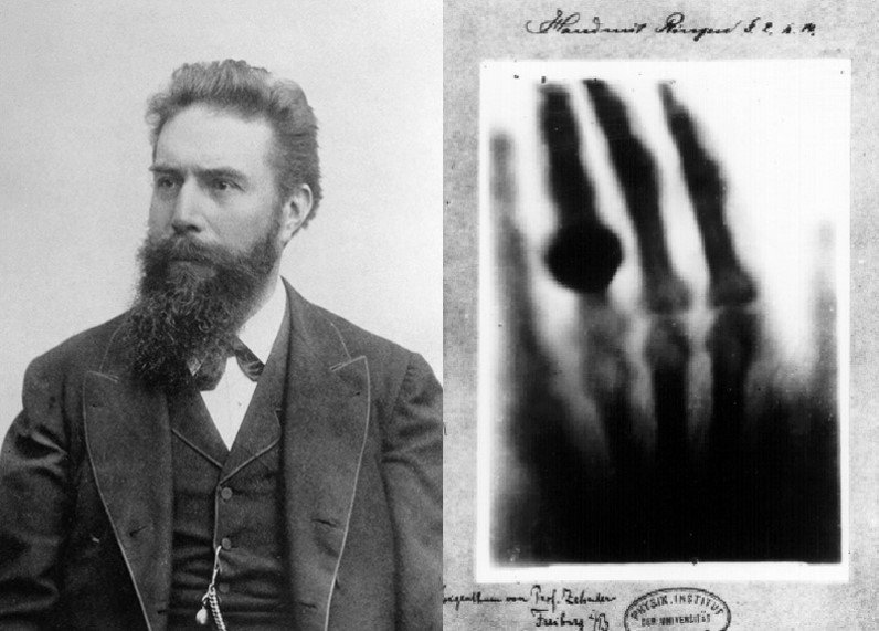 Primera radiografía, la mano de su mujer